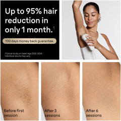 Braun Smart IPL, Silk·Expert Pro 5: At Home Alternative to Laser Hair Removal with 2 Caps and Leather Pouch, IPL5137
